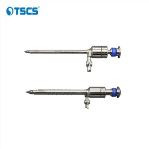 복강경 검사에 의해 진단되는 것